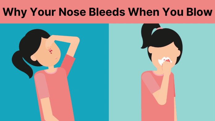 Why Your Nose Bleeds When You Blow It?