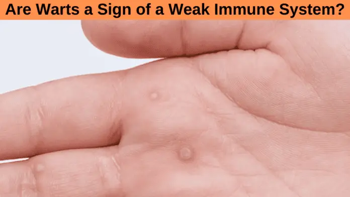 Are Warts a Sign of a Weak Immune System