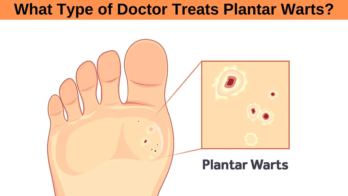 What Type Of Doctor Treats Plantar Warts Myhealthgeek