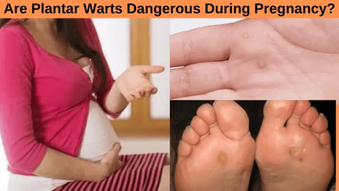 Are Plantar Warts Dangerous During Pregnancy