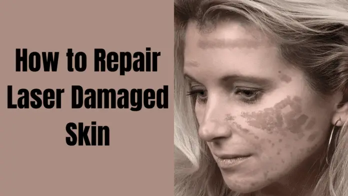 How to Repair Laser Damaged Skin
