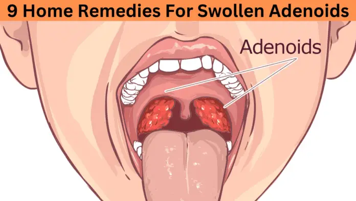 Swollen Adenoids Home Remedies