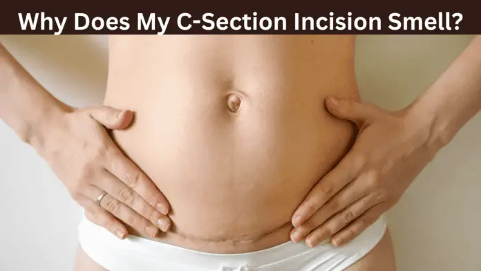 Why Does My C-Section Incision Smell