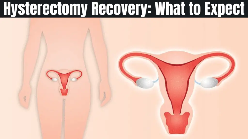 Is Recovery from a Hysterectomy Similar to a C-Section?