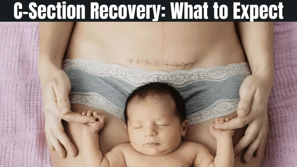 Is Recovery from a Hysterectomy Similar to a C-Section?