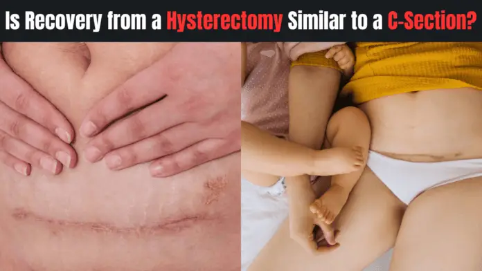 Is Recovery from a Hysterectomy Similar to a C-Section?