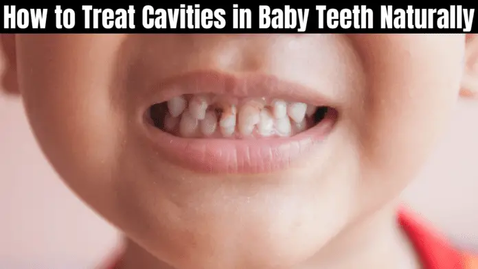 How to Treat Cavities in Baby Teeth Naturally