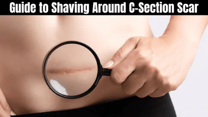 Guide to Shaving Around C-Section Scar