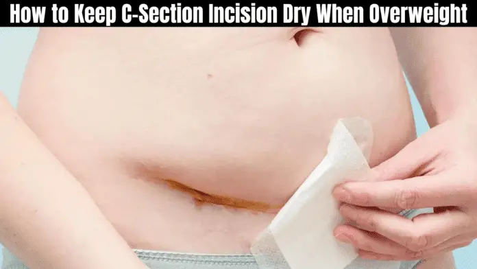 How to Keep C-Section Incision Dry When Overweight