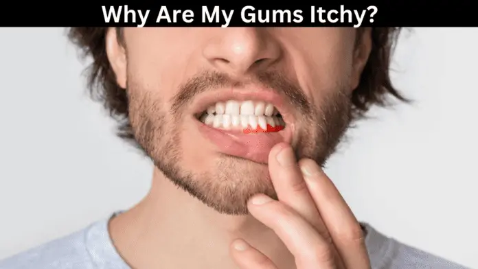 Why Are My Gums Itchy?