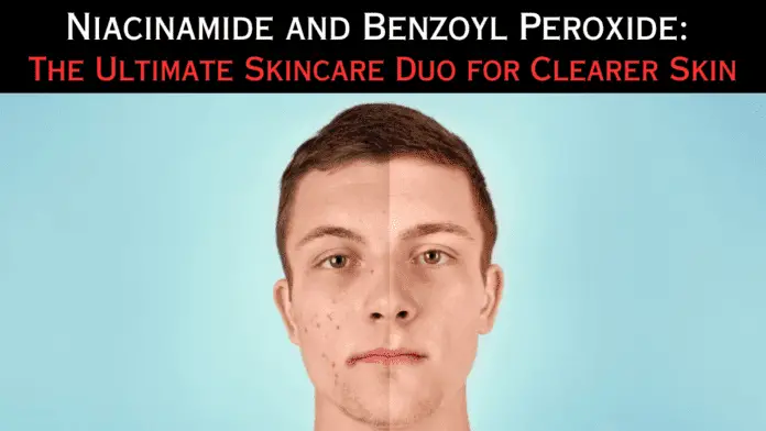 Niacinamide and Benzoyl Peroxide