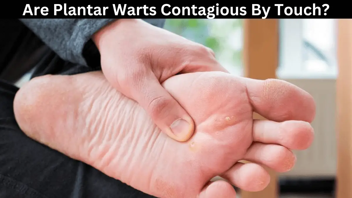 Are Plantar Warts Contagious By Touch Myhealthgeek