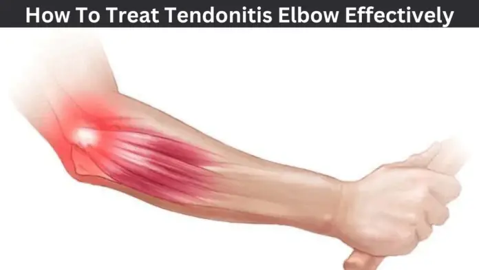 How To Treat Tendonitis Elbow Effectively