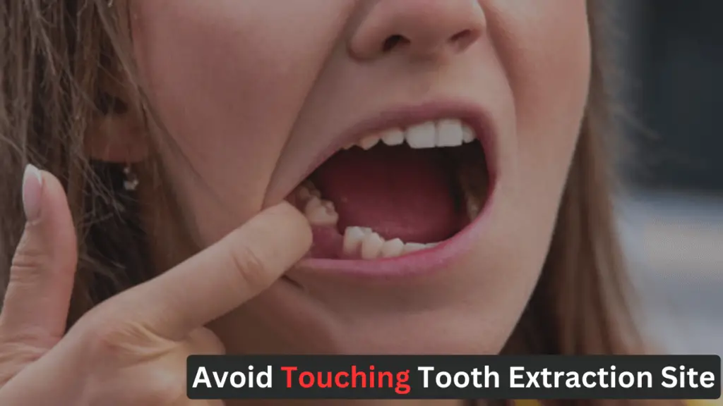 Post Tooth Extraction Care