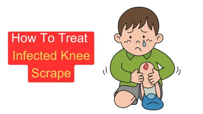 How To Treat Infected Knee Scrape