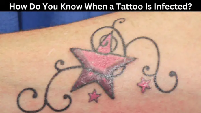 How Do You Know When a Tattoo Is Infected?